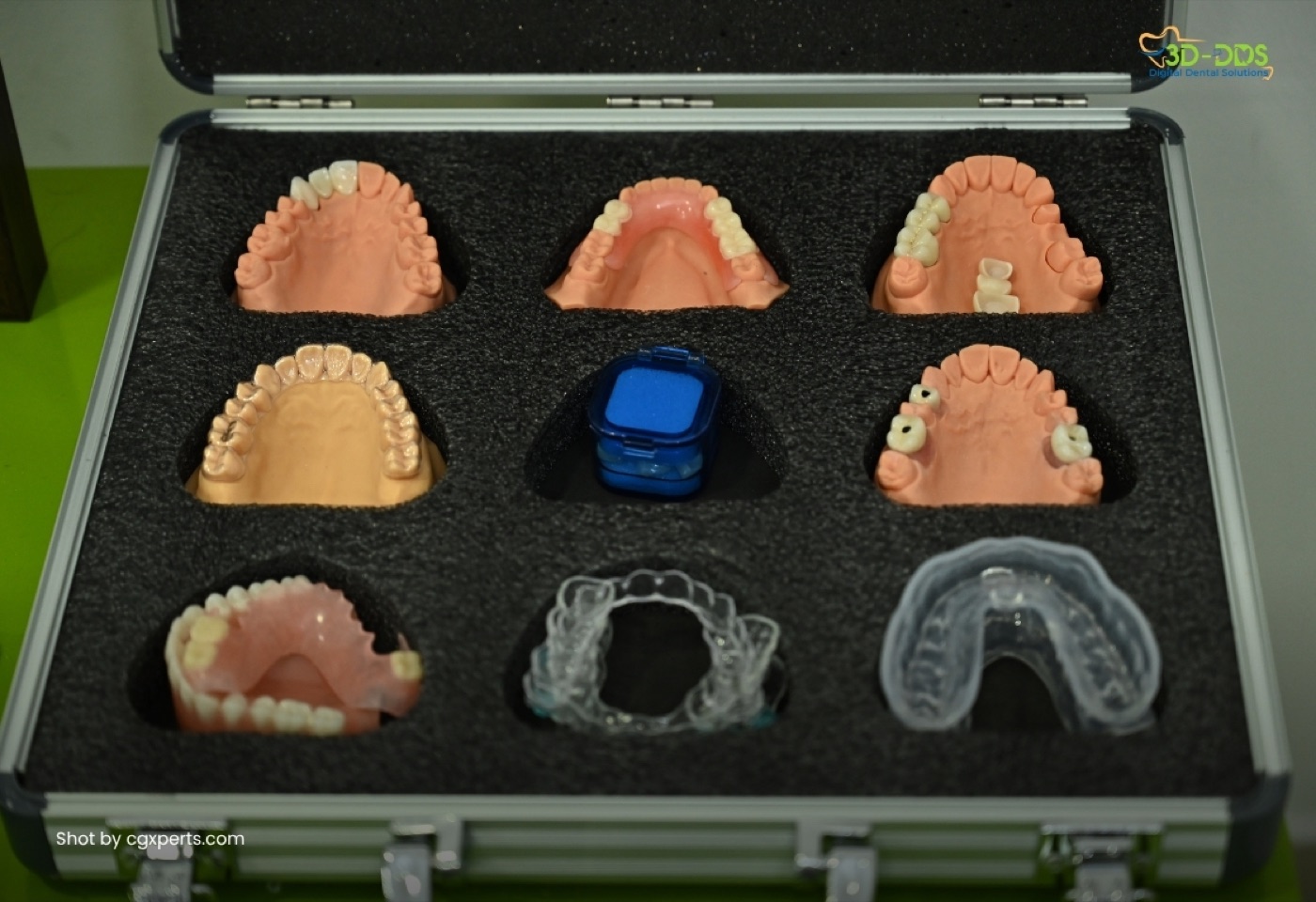 Invisible Aligners at 3D-DDS